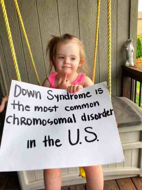 Facts about Down Syndrome